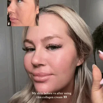 Dokonalá pleť